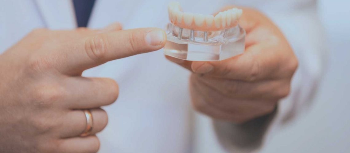 a model of a placed implant supported denture